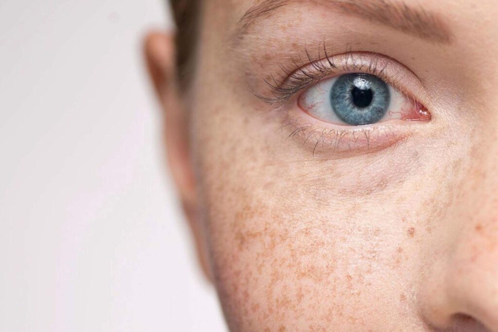 Principia olheiras como usar: principia olheiras funciona? confira